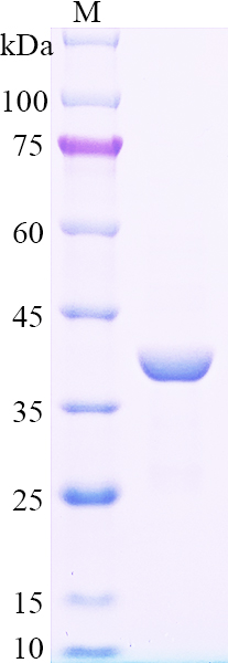 Recombinant Human ERMP1 SDS-PAGE