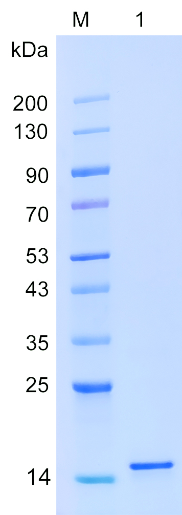 Recombinant GRIK3 protein (His tag) SDS-PAGE