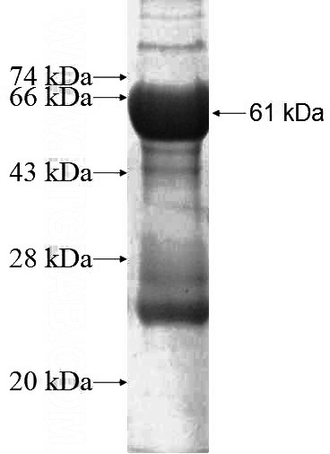 Recombinant Human RALGPS1 SDS-PAGE