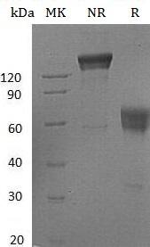 Human FAS/APT1/FAS1/TNFRSF6 (Fc tag) recombinant protein