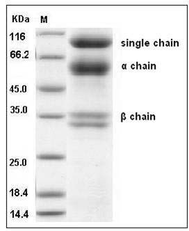 Human HGF / Hepatocyte Growth Factor Protein SDS-PAGE