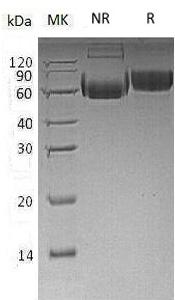 Human LILRB2/ILT4/LIR2/MIR10 (His tag) recombinant protein