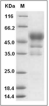 Rat CD52 / CDW52 Protein (Fc Tag) SDS-PAGE