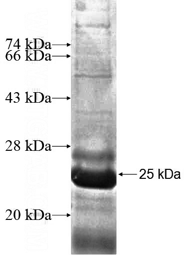 Recombinant Human NDUFAF2 SDS-PAGE