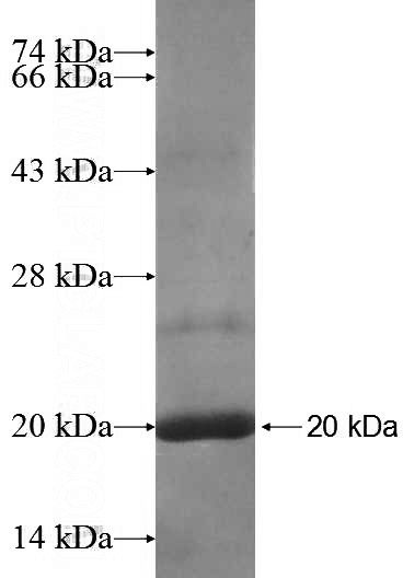 Recombinant Human FCHO1 SDS-PAGE