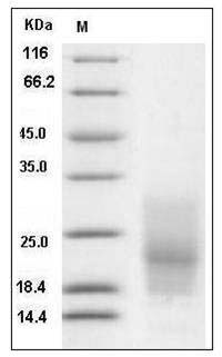 Human CD63 / Tspan-30 / Tetraspanin-30 Protein (His Tag) SDS-PAGE