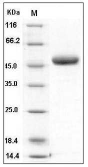 Human Chitotriosidase / Chitinase 1 / CHIT1 Protein (His Tag) SDS-PAGE