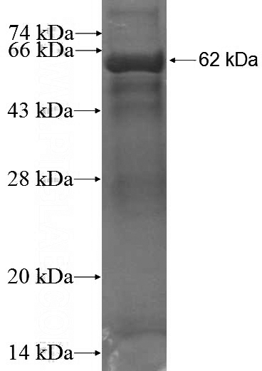 Recombinant Human HPS1 SDS-PAGE