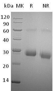Human TIMP1/CLGI/TIMP (His tag) recombinant protein