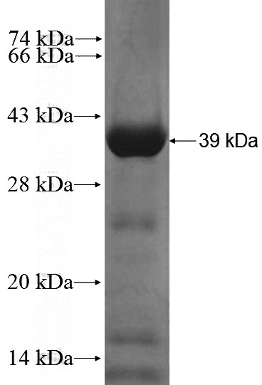 Recombinant Human VPS45 SDS-PAGE