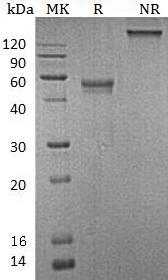 Human XCL1/LTN/SCYC1 (Fc & His tag) recombinant protein