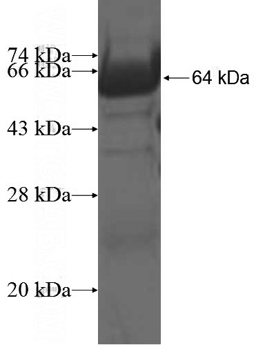 Recombinant Human GNA14 SDS-PAGE