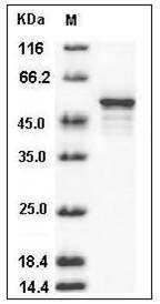 Human DOT1L / KMT4 Protein SDS-PAGE