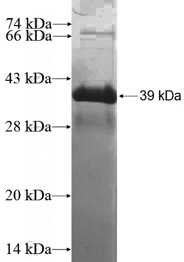 Recombinant Human RASGRP1 SDS-PAGE
