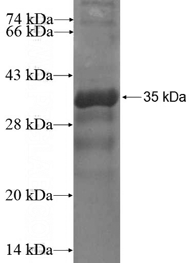Recombinant Human SLC17A9 SDS-PAGE