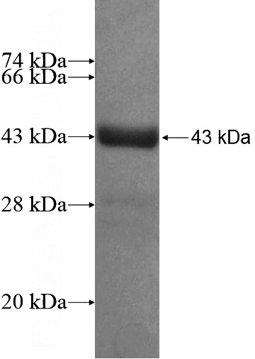 Recombinant Human MAGEB3 SDS-PAGE