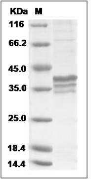 Human MRPL44 Protein (His Tag) SDS-PAGE