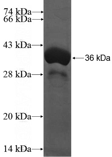 Recombinant Human CDCA8 SDS-PAGE