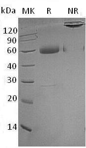 Human TNFRSF1A/TNFAR/TNFR1 (Fc tag) recombinant protein