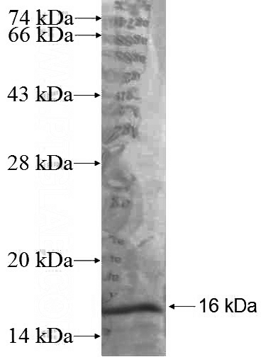 Recombinant Human DUSP1 SDS-PAGE