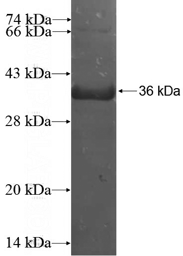 Recombinant Human ITIH2 SDS-PAGE
