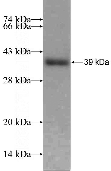 Recombinant Human EIF3L SDS-PAGE