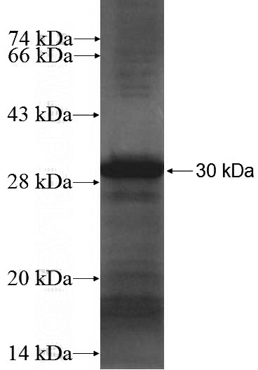 Recombinant Human GDI2 SDS-PAGE
