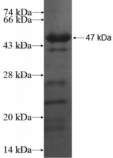 Recombinant Human CCNK SDS-PAGE