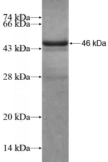 Recombinant Human ETS2 SDS-PAGE