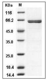 Human AIM2 Protein (GST Tag) SDS-PAGE