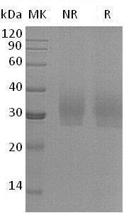 Human SDC2/HSPG1 (His tag) recombinant protein