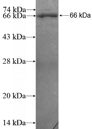 Recombinant Human TRAF5 SDS-PAGE