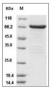 Human FGFR2 / CD332 Protein (aa 400-821, His & GST Tag) SDS-PAGE