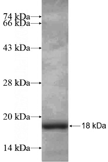 Recombinant Human TEX12 SDS-PAGE