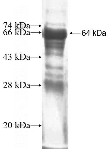 Recombinant Human EFHC1 SDS-PAGE