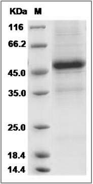 Rat Interleukin 25 / IL25 / IL17E Protein (Fc Tag) SDS-PAGE