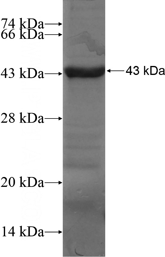 Recombinant Human SPATA2 SDS-PAGE
