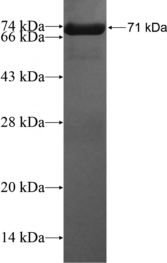 Recombinant Human RCC1 SDS-PAGE