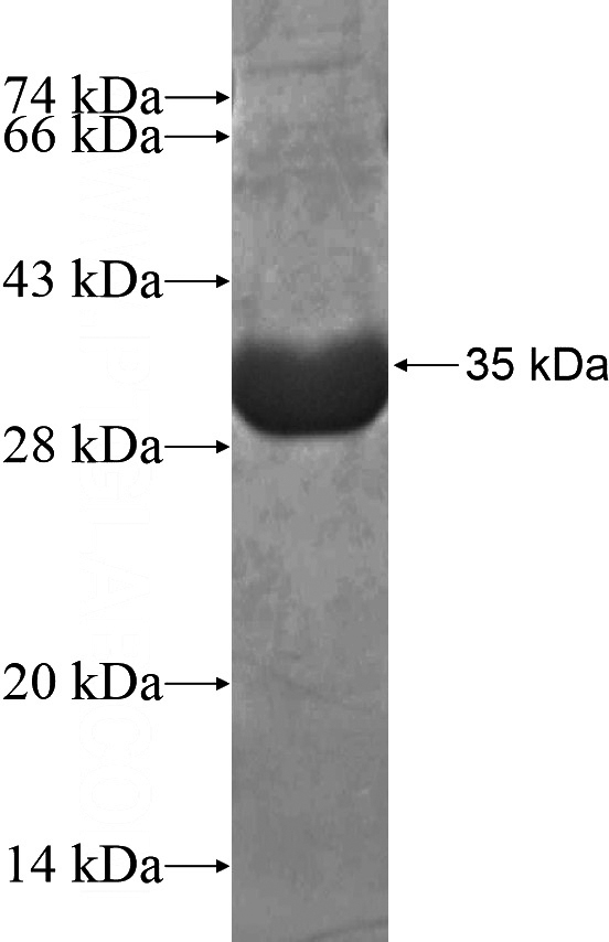 Recombinant Human DGKG SDS-PAGE