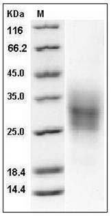 Mouse TRAIL R2 / CD262 / TNFRSF10B Protein (His Tag) SDS-PAGE