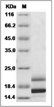 Human IL17 / IL17A Protein (His Tag) SDS-PAGE