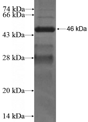 Recombinant Human TNFAIP1 SDS-PAGE