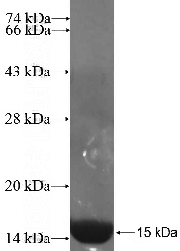 Recombinant Human AP4S1 SDS-PAGE