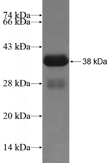 Recombinant Human FLNA SDS-PAGE