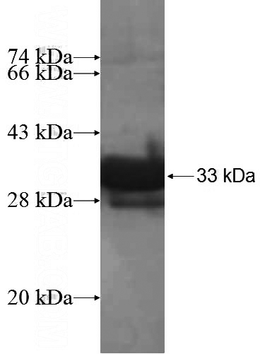 Recombinant Human NDUFA2 SDS-PAGE