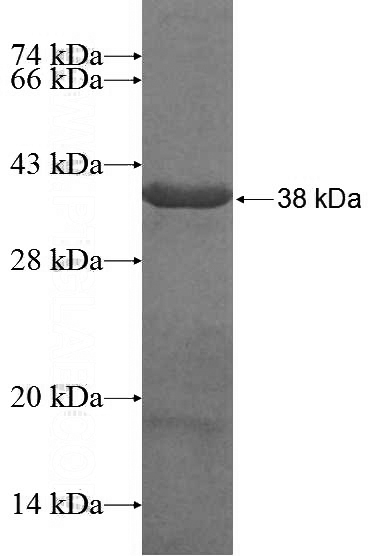 Recombinant Human ROGDI SDS-PAGE