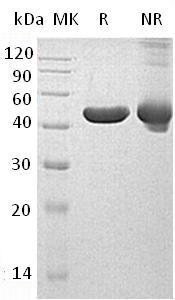 Human INPP5A (His tag) recombinant protein