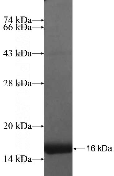 Recombinant Human ADAMTS4 SDS-PAGE