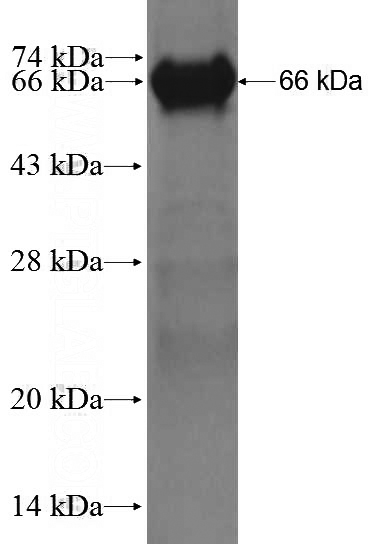 Recombinant Human ZNHIT6 SDS-PAGE