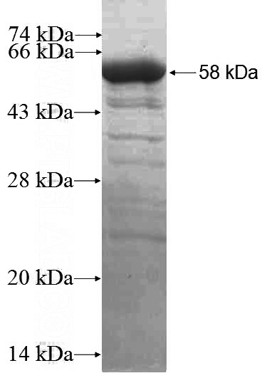 Recombinant Human RNASEH1 SDS-PAGE